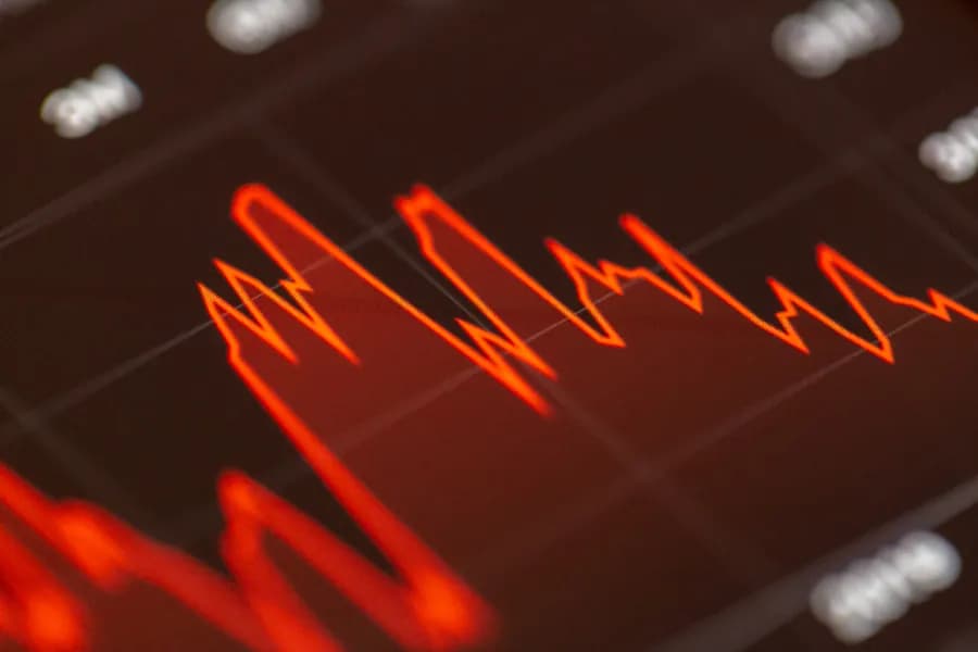 A line chart showing a price moving sharply up and down